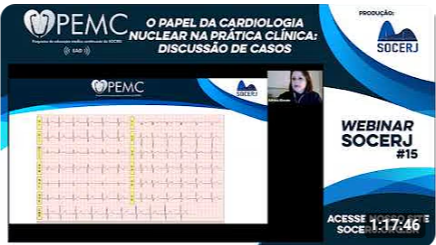  O Papel da Cardiologia Nuclear na Prática Clínica